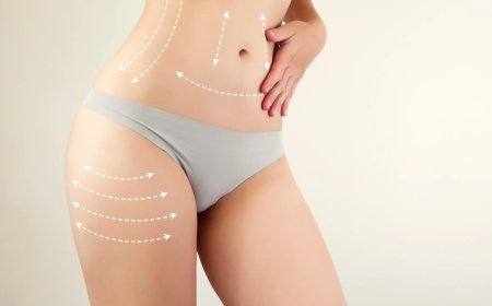 Pro Healing Advice from Best Liposuction Surgeons in Dubai