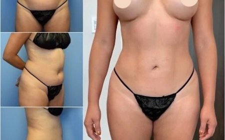Get the Perfect Body Shape with Body Contouring in Dubai
