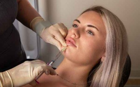 Lips & the Art of Subtle Enhancement: Natural-Looking Fillers