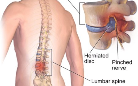 Aspadol 200 mg: Powerful Relief for Severe Pain – Complete Patient Guide