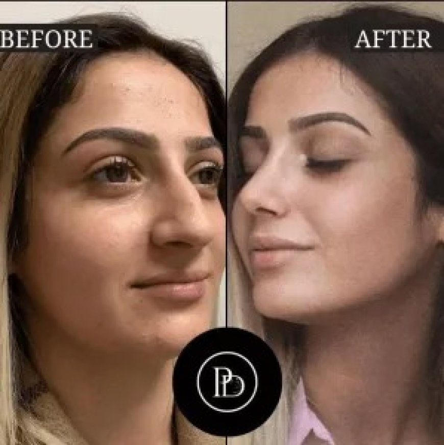 Looking for the Best Aesthetic Clinic in Dubai? I Recommend Perfectdrs