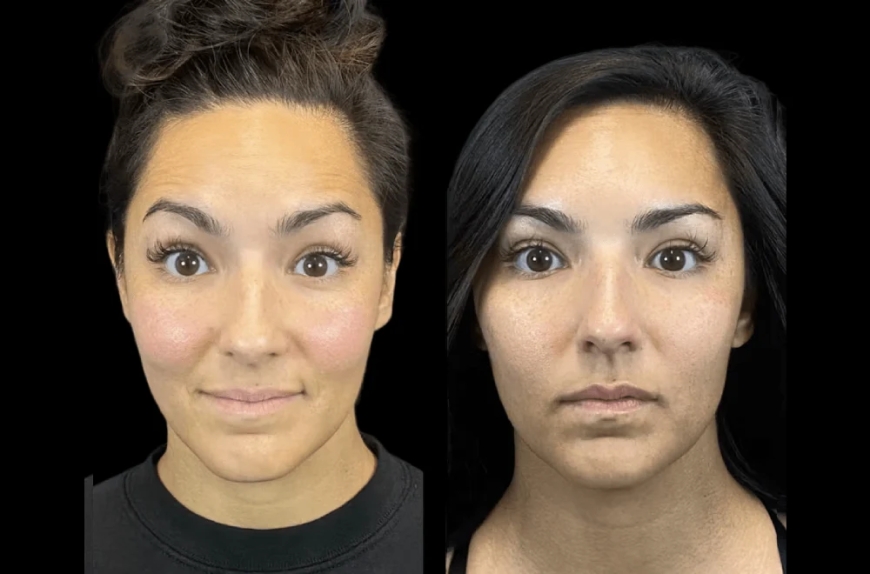 The Future of Anti-Aging Starts at the Best Aesthetic Clinic in Dubai