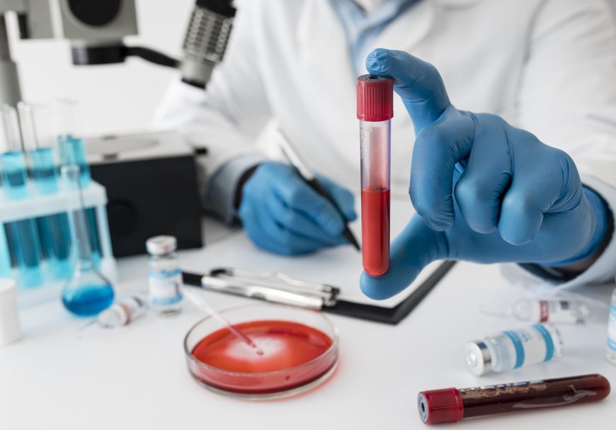 Reliable Blood Test in Bangalore: Fast & Accurate Diagnostic Services