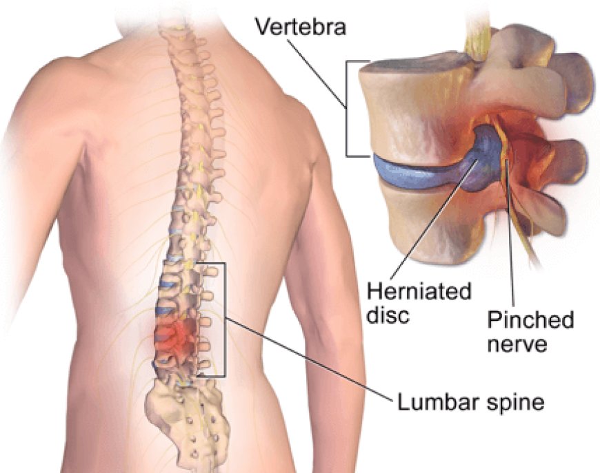 Aspadol 200 mg: Powerful Relief for Severe Pain – Complete Patient Guide